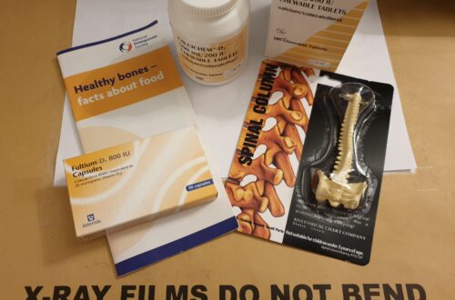 A brown envelope of x-rays which says 'X-ray films do not bend' on the outside. On top of the envelope is a national osteoporosis society healthy bones booklet, vitamin D tablets, Calcichew D3 tablets and a keyring of the spine to illustrate osteoporosis.